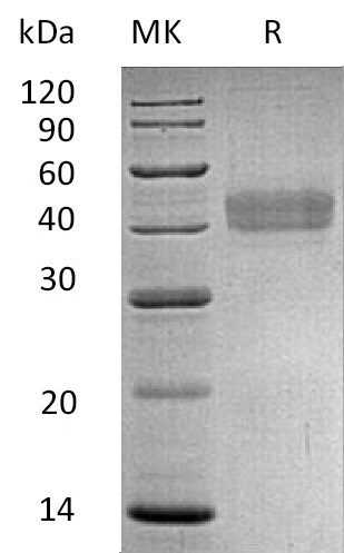 Human DKK-1 +SDS-PAGE-1.jpg